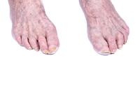Understanding Changes in Elderly Foot Health