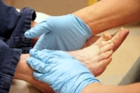 Caring for Diabetic Feet Starts with Everyday Awareness